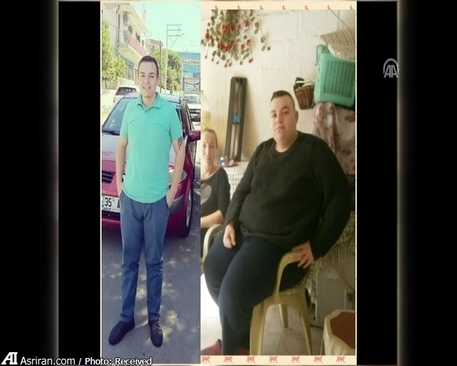 شکست عشقی دلیل کاهش وزن 100 کیلویی! + عکس
