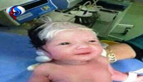 تولد نوزاد سفید موی در لبنان نشانه آخر الزمان است؟ + عکس