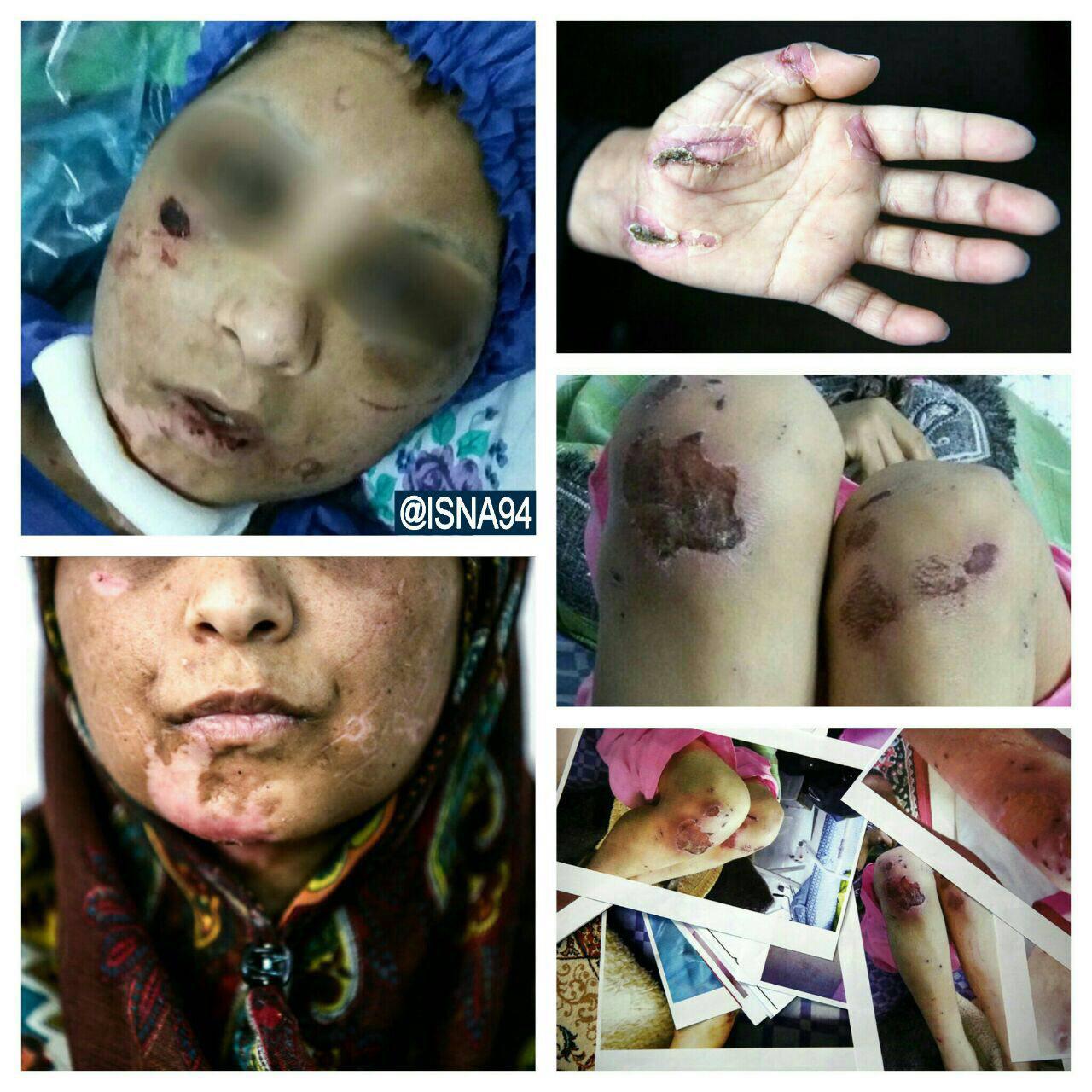 شکنجه 21 روزه زن مشهدی و دو دخترش توسط شوهر+تصاویر