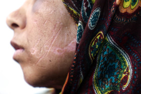 زن مشهدی و دو دخترش 21 روز توسط شوهر معتاد شکنجه شدند