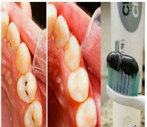 ژاپنی های خمیر دندان معجزه گر ساختند! 
